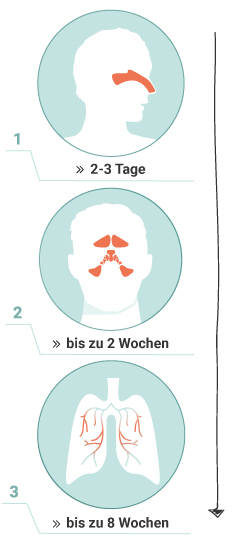 Darstellung des Krankheitsverlauf eine Sinubronchitis