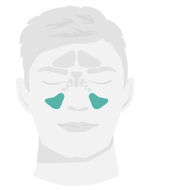Lage der Kieferhöhlen Die Kieferhöhlen liegen auf beiden Seiten im Gesicht neben der Nase.